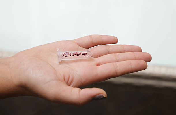 انجام آزمایش PCR برای کارکنان درسا و خانوادهها انجام آزمایش PCR برای کارکنان درسا و خانوادهها
